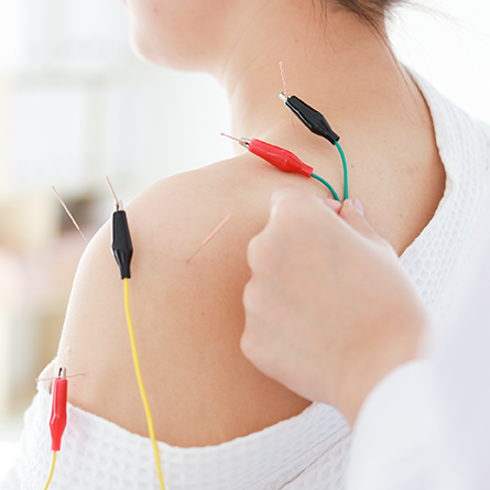 Image for Dry Needling